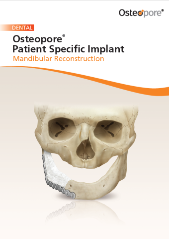 PSI for Mandibular Reconstruction